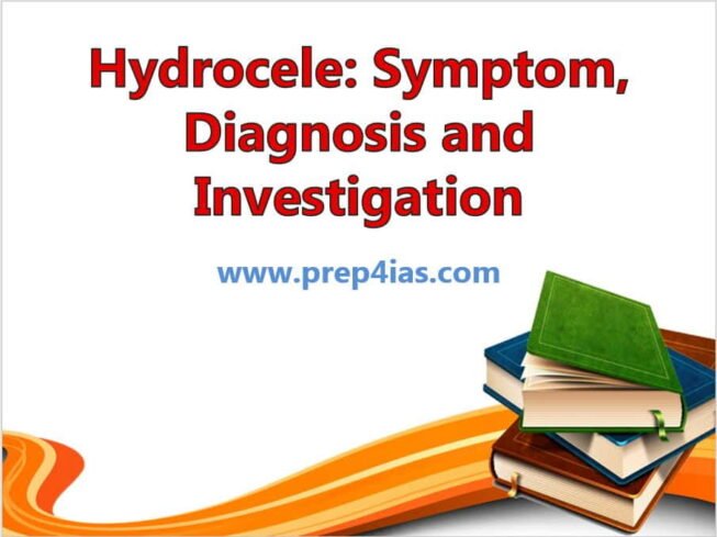 Hydrocele: Symptom, Diagnosis and Investigation | Medical Test for UPSC 3